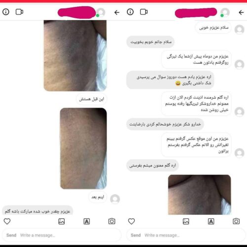 کرم روشن کننده بدن و ضد لک سوماتلین