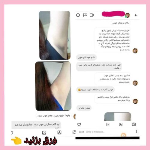 کرم روشن کننده بدن و ضد لک سوماتلین